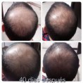 /album/algunos-resultados-reales/a11951969-10204687093323843-5387539360790989498-n-copia-copia-jpg/